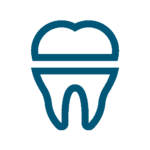 Perfect Placement - Dental Crowns